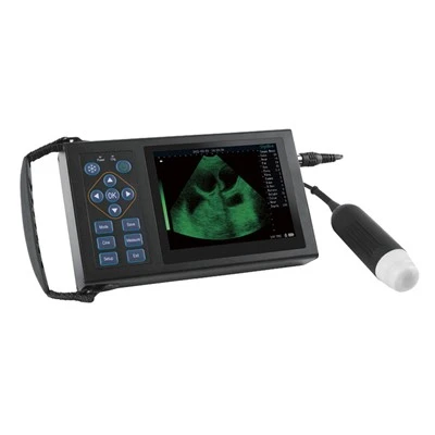 Handfleld Portatiound Ultratovush qurilmalari
